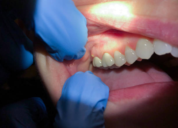 Best Broken or Cracked Tooth Emergency Dentist in Alcoa, TN